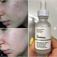 The Ordinary Serum With Batch Code Niacinamide 10% + Zinc 1%
